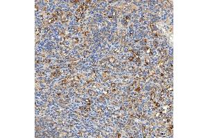 IHC analysis of SNPH using anti-SNPH antibody (ABIN7601724). (Syntaphilin Antikörper  (AA 43-482))