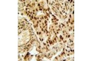 Immunohistochemistry (Paraffin-embedded Sections) (IHC (p)) image for anti-Histone Deacetylase 2 (HDAC2) (AA 417-447), (Middle Region) antibody (ABIN952698)