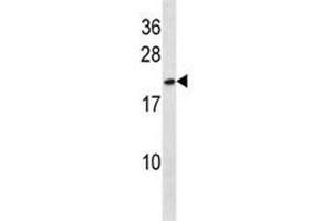 HMGB3 antibody western blot analysis in NCI-H292 lysate. (HMGB3 Antikörper  (AA 50-79))