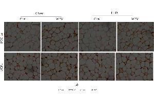 Immunohistochemistry (IHC) image for anti-Uncoupling Protein 1 (Mitochondrial, Proton Carrier) (UCP1) (AA 101-200) antibody (ABIN675413)