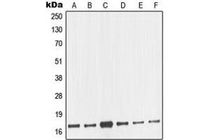 Western blot analysis of nm23-H2 expression in MCF7 (A), HeLa (B), A431 (C), Jurkat (D), K562 (E), BJAB (F) whole cell lysates.