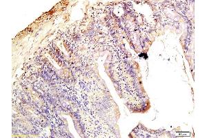 Formalin-fixed and paraffin embedded rat intestine tissue labeled with Anti-Claudin 1 Polyclonal Antibody, Unconjugated (ABIN686407) followed by conjugation to the secondary antibody and DAB staining (Claudin 1 Antikörper  (AA 121-211))