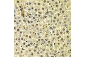 Immunohistochemistry of paraffin-embedded rat liver using DTNBP1 antibody at dilution of 1:100 (x400 lens).