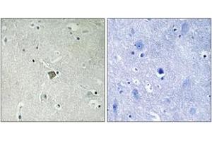 Immunohistochemistry analysis of paraffin-embedded human brain tissue, using Bax (Ab-184) Antibody. (BAX Antikörper  (AA 143-192))