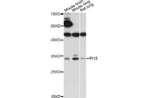 Western blot analysis of extracts of various cell lines, using PI15 antibody (ABIN6289972) at 1:1000 dilution. (PI15 Antikörper)