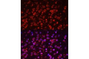 Immunofluorescence analysis of mouse brain using STAT3 antibody. (STAT3 Antikörper  (AA 640-770))