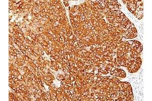 anti-Melanoma Cell Marker antibody