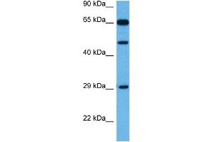 Host:  Rabbit  Target Name:  TP73  Sample Tissue:  Mouse Kidney  Antibody Dilution:  1ug/ml (Tumor Protein p73 Antikörper  (Middle Region))
