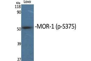 Western Blot (WB) analysis of specific cells using Phospho-MOR-1 (S375) Polyclonal Antibody. (Mu Opioid Receptor 1 Antikörper  (pSer375))