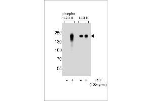 Western blot analysis of extracts from A431 cells, untreated or treated with EGF, using phospho EGFR- (left) or ErBB2 antibody (right) (EGFR Antikörper  (pTyr1172))
