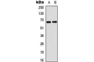 Western blot analysis of PAK1 expression in A431 (A), HEK293T (B) whole cell lysates. (PAK1 Antikörper  (Center))