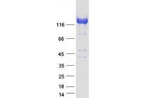 Western Blotting (WB) image for Diaphanous Homolog 1 (DIAPH1) (Transcript Variant 1) protein (Myc-DYKDDDDK Tag) (ABIN2719471)