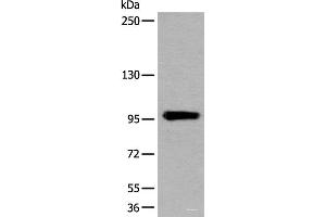 Western blot analysis of Human heart tissue lysate using UNC45B Polyclonal Antibody at dilution of 1:600 (UNC45B Antikörper)