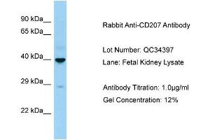 Host: Rabbit Target Name: CD207 Sample Type: Fetal Kidney Antibody Dilution: 1. (CD207 Antikörper  (C-Term))