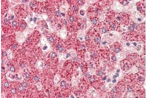 Human Liver: Formalin-Fixed, Paraffin-Embedded (FFPE)