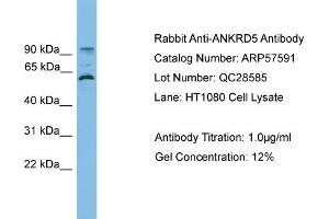 WB Suggested Anti-ANKRD5  Antibody Titration: 0. (ANKRD5 Antikörper  (N-Term))