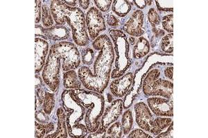 Immunohistochemical staining of human kidney with OR8S1 polyclonal antibody  shows strong cytoplasmic positivity in cells in tubules at 1:50-1:200 dilution.