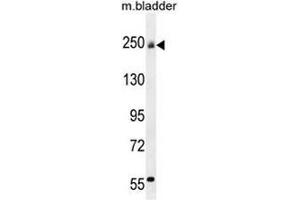 Western Blotting (WB) image for anti-Collagen, Type V (COL5) (AA 61-90), (N-Term) antibody (ABIN951624)