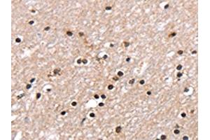 The image on the left is immunohistochemistry of paraffin-embedded Human brain tissue using ABIN7130904(RNF40 Antibody) at dilution 1/25, on the right is treated with fusion protein. (RNF4 Antikörper)