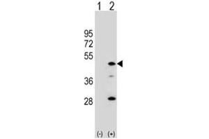 Western blot analysis of AADAC antibody and 293 cell lysate either nontransfected (Lane 1) or transiently transfected (2) with the AADAC gene. (AADAC Antikörper  (AA 273-300))