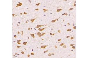 Immunohistochemistry (Paraffin-embedded Sections) (IHC (p)) image for anti-Ubiquinol-Cytochrome C Reductase Complex Chaperone (UQCC) antibody (ABIN7076094)