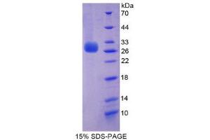 SDS-PAGE (SDS) image for Perforin 1 (Pore Forming Protein) (PRF1) (AA 120-353) protein (His tag) (ABIN2126260)
