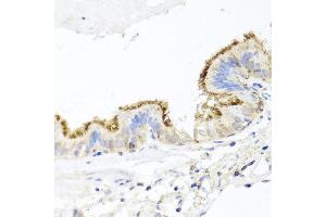 Immunohistochemistry of paraffin-embedded human trachea using CD44 antibody at dilution of 1:100 (x40 lens). (CD44 Antikörper)