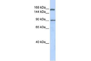 WB Suggested Anti-AFF2 Antibody Titration:  0. (AFF2 Antikörper  (Middle Region))