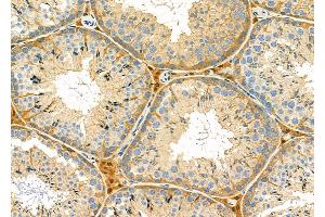 ABIN6259807 and ABIN6276801 at 1/100 staining Mouse testis tissue by IHC-P.