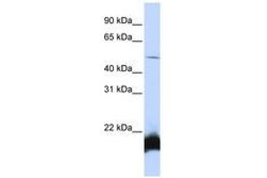 Image no. 1 for anti-One Cut Homeobox 1 (ONECUT1) (N-Term) antibody (ABIN6740547) (ONECUT1 Antikörper  (N-Term))