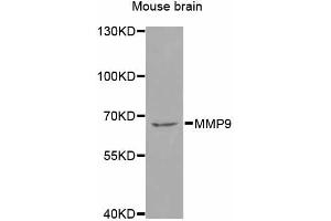 Western blot analysis of extracts of mouse brain, using MMP9 antibody (ABIN4904400) at 1:1000 dilution. (MMP 9 Antikörper)