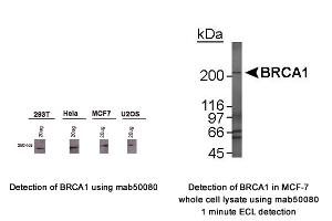 Image no. 1 for anti-Breast Cancer 1 (BRCA1) (AA 1314-1600), (AA 1314-1864) antibody (ABIN363234) (BRCA1 Antikörper  (AA 1314-1600, AA 1314-1864))