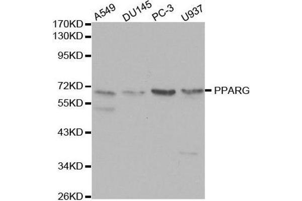 PPARG Antikörper  (AA 50-150)