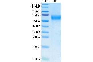 SDS-PAGE (SDS) image for Interleukin 2 Receptor, gamma (IL2RG) (AA 23-254) protein (His tag,Biotin) (ABIN7274059)
