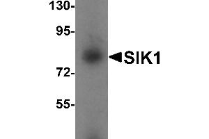 Western blot analysis of SIK1 in human small intestine tissue lysate with SIK1 antibody at 1 µg/mL. (SIK1 Antikörper  (Middle Region))