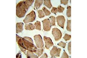 Formalin-fixed and paraffin-embedded human skeletal muscle reacted with Denatured ATG1 Antibody , which was peroxidase-conjugated to the secondary antibody, followed by DAB staining. (ULK1 Antikörper)