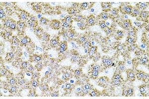 Immunohistochemistry of paraffin-embedded Rat liver using ALDH1A1 Polyclonal Antibody at dilution of 1:100 (40x lens). (ALDH1A1 Antikörper)