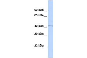 Host:  Rabbit  Target Name:  FKTN  Sample Type:  Fetal Brain lysates  Antibody Dilution:  1. (Fukutin Antikörper  (N-Term))