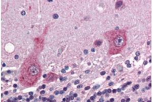 Human Brain, Cerebellum (formalin-fixed, paraffin-embedded) stained with GRIK5 antibody ABIN343908 at 5 ug/ml followed by biotinylated goat anti-rabbit IgG secondary antibody ABIN481713, alkaline phosphatase-streptavidin and chromogen. (GRIK5 Antikörper  (C-Term))
