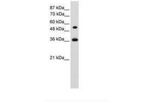 Image no. 1 for anti-Homeobox C11 (HOXC11) (AA 152-201) antibody (ABIN203334) (HOXC11 Antikörper  (AA 152-201))