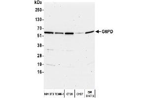 Western Blotting (WB) image for anti-Glucose-6-Phosphate Dehydrogenase (G6PD) (AA 50-100) antibody (ABIN7449226) (Glucose-6-Phosphate Dehydrogenase Antikörper  (AA 50-100))