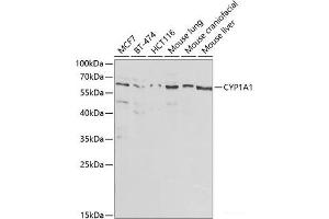 Western Blotting (WB) image for anti-Cytochrome P450, Family 1, Subfamily A, Polypeptide 1 (CYP1A1) antibody (ABIN7010003)