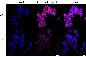 Immunocytochemical staining of Hela cells using Kinesin light chain 1 antibody (ABIN7799210), 1:1,000), Top panel: wild-type (WT), Bottom panal: Kinesin light chain 1 shRNA knockdown (KD). (Rekombinanter KLC1 Antikörper)