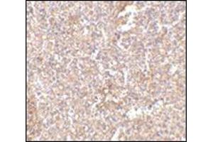 Immunohistochemistry of STEAP1 in human spleen tissue with this product at 2. (STEAP1 Antikörper  (Center))