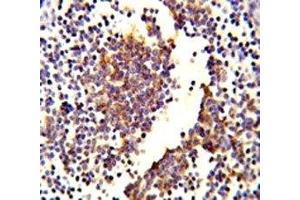 IHC analysis of FFPE human lymph tissue stained with C7 antibody (C7 Antikörper  (AA 375-403))