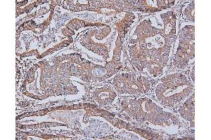 IHC analysis of DDR1 using anti-DDR1 antibody (ABIN7601407). (DDR1 Antikörper  (AA 341-909))
