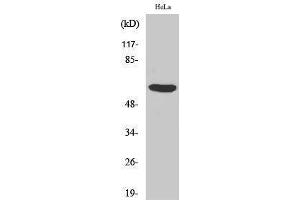 Western Blotting (WB) image for anti-PHD Finger Protein 1 (PHF1) (Internal Region) antibody (ABIN3176864) (PHF1 Antikörper  (Internal Region))