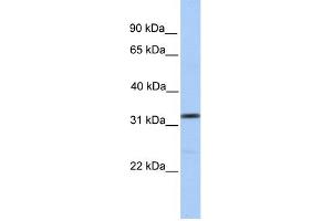 WB Suggested Anti-SPRY3 Antibody Titration:  0. (SPRY3 Antikörper  (N-Term))