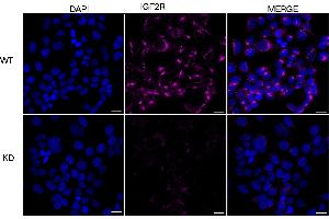 Immunocytochemical staining of HeLa cells using IGF2R antibody (ABIN7799053), 1:1,000), Top panel: wild-type (WT), Bottom panal: IGF2R shRNA knockdown (KD). (Rekombinanter IGF2R Antikörper)