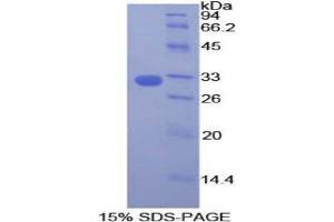 SDS-PAGE (SDS) image for Dedicator of Cytokinesis 1 (DOCK1) (AA 1200-1435) protein (His tag) (ABIN1878348) (DOCK1 Protein (AA 1200-1435) (His tag))